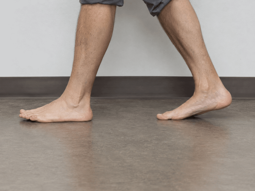 Flat Feet Treated In Santa Monica, CA